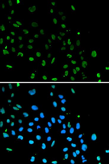XRCC5 / Ku80 Antibody