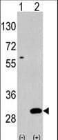 Polyclonal Rabbit anti-Human UBTD1 Antibody (aa180-212, IHC, WB)
