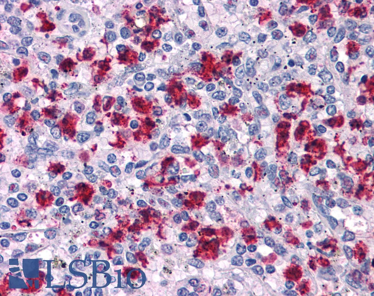 IHC-plus™ ARHGAP18 Antibody