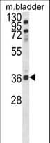 CCDC3 Antibody (aa195-222)