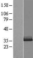 VCX Protein (Over-Expression Lysate Myc-DDK (Flag))