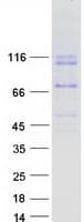 Human DSC2 / Desmocollin 2 Protein (Recombinant Myc-DDK (Flag))