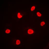 PRKDC / DNA-PKcs Antibody (C-Terminus)