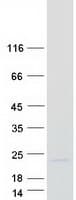 Human RGS13 Protein (Recombinant Myc-DDK (Flag))