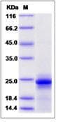 Mouse IL6 / Interleukin 6 Protein (Recombinant)