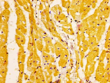 EPHA6 / EPH Receptor A6 Antibody
