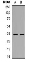Polyclonal Rabbit anti-Human MARCH5 Antibody (Internal, IF, WB)