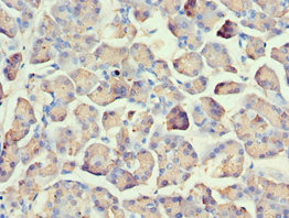 Polyclonal Rabbit anti-Human AMY2A / Pancreatic Amylase Antibody (aa242-511, IHC, WB)