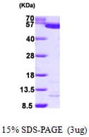Human PKLR Protein (Recombinant His)