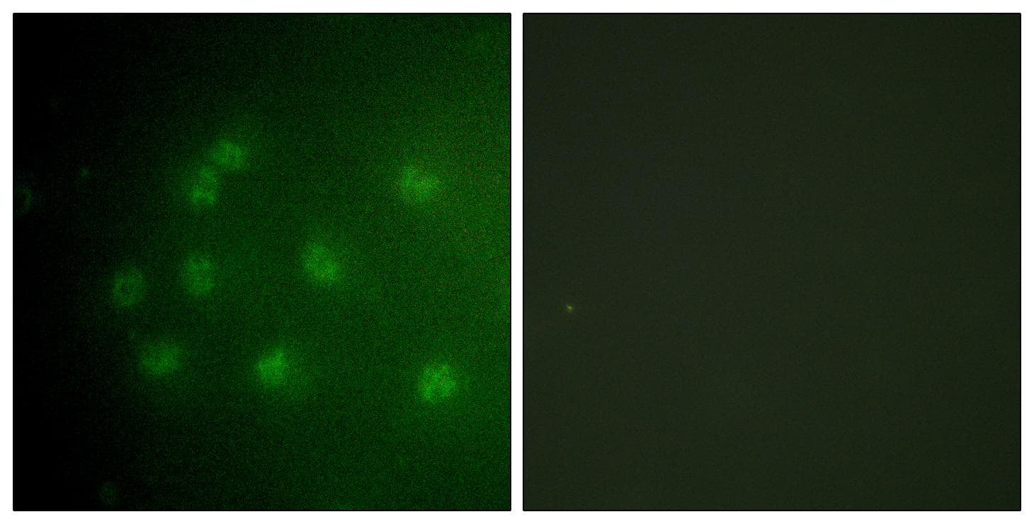 Polyclonal Rabbit anti-Human RB1 / Retinoblastoma / RB Antibody (phospho-Thr826, IF, WB)