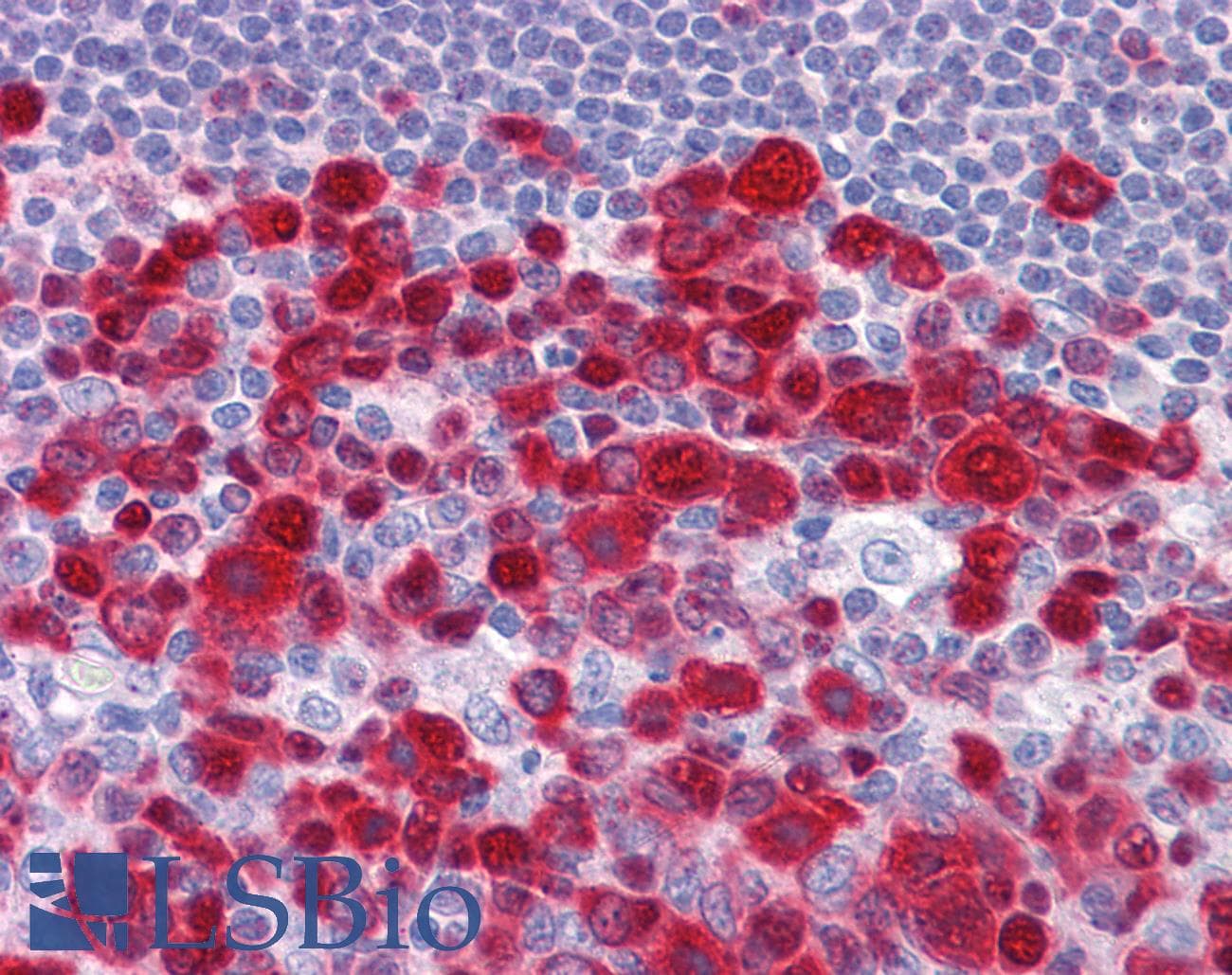IHC-plus™ DUT / DUTPase Antibody (clone 1C9)