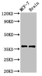 MENT / C1orf56 Antibody