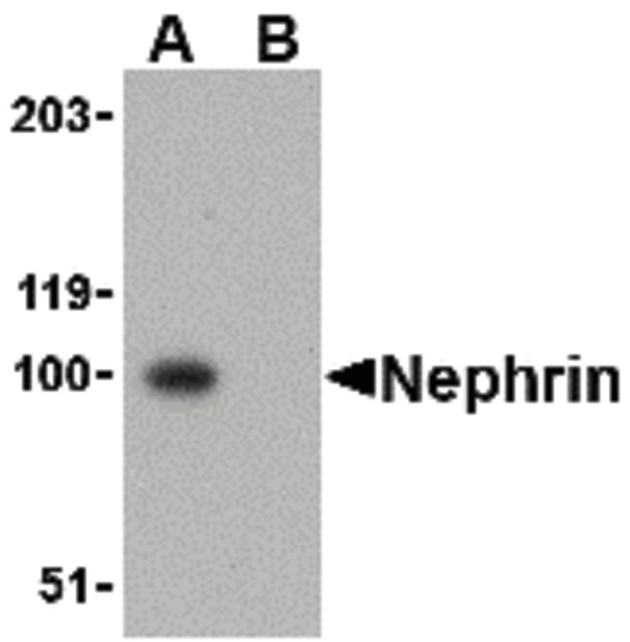 Polyclonal Rabbit anti-Human NPHS1 / Nephrin Antibody (IHC, IF, WB)
