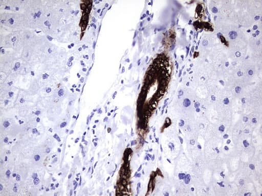 KRT7 / CK7 / Cytokeratin 7 Antibody (aa1-114, clone UMAB161)