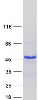 Human TMOD1 / Tropomodulin 1 Protein (Recombinant Myc-DDK (Flag))