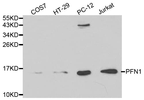 PFN1 / Profilin 1 Antibody