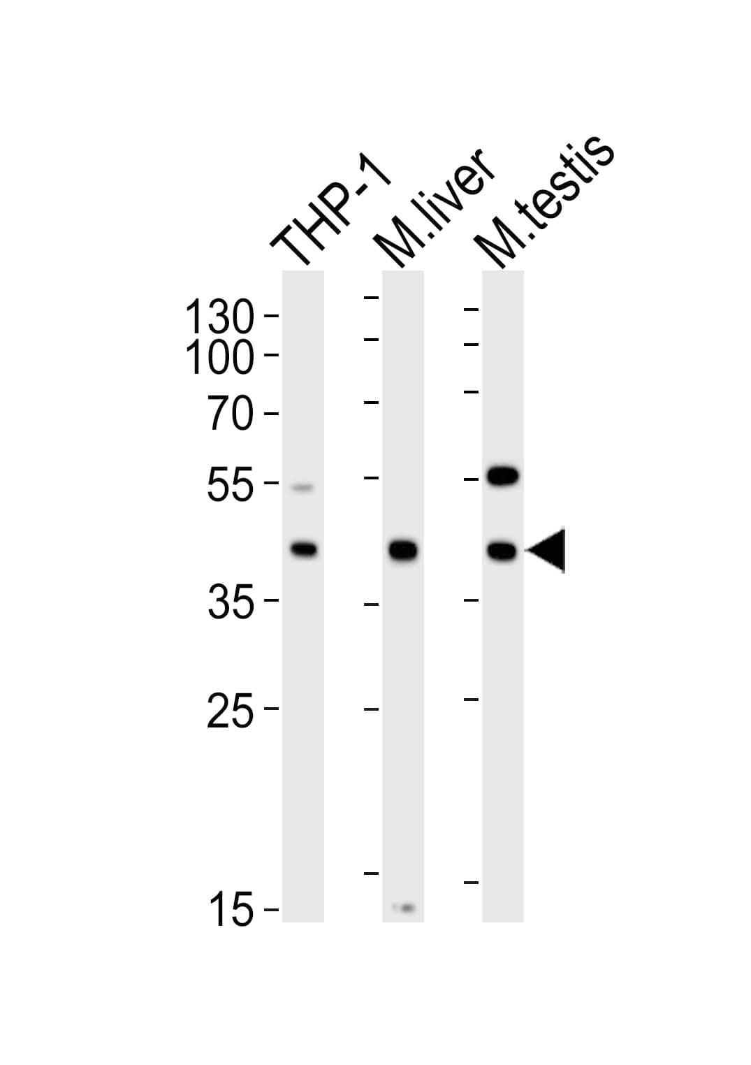 ATG3 Antibody (clone 1377CT239.6.1.12)