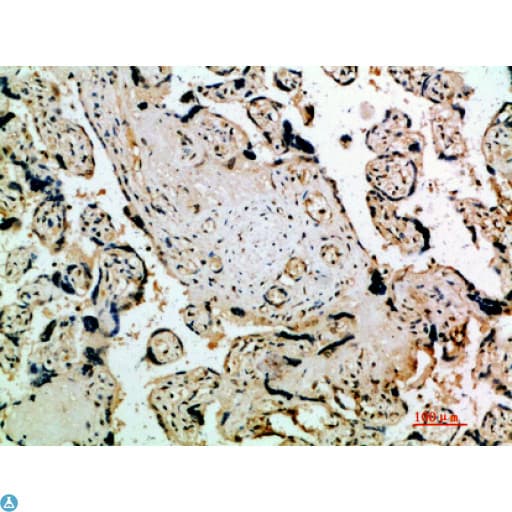 FLT4 / VEGFR3 Antibody (aa640-700)