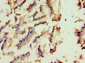 Polyclonal Rabbit anti-Human KIF6 Antibody (aa565-814, IHC)