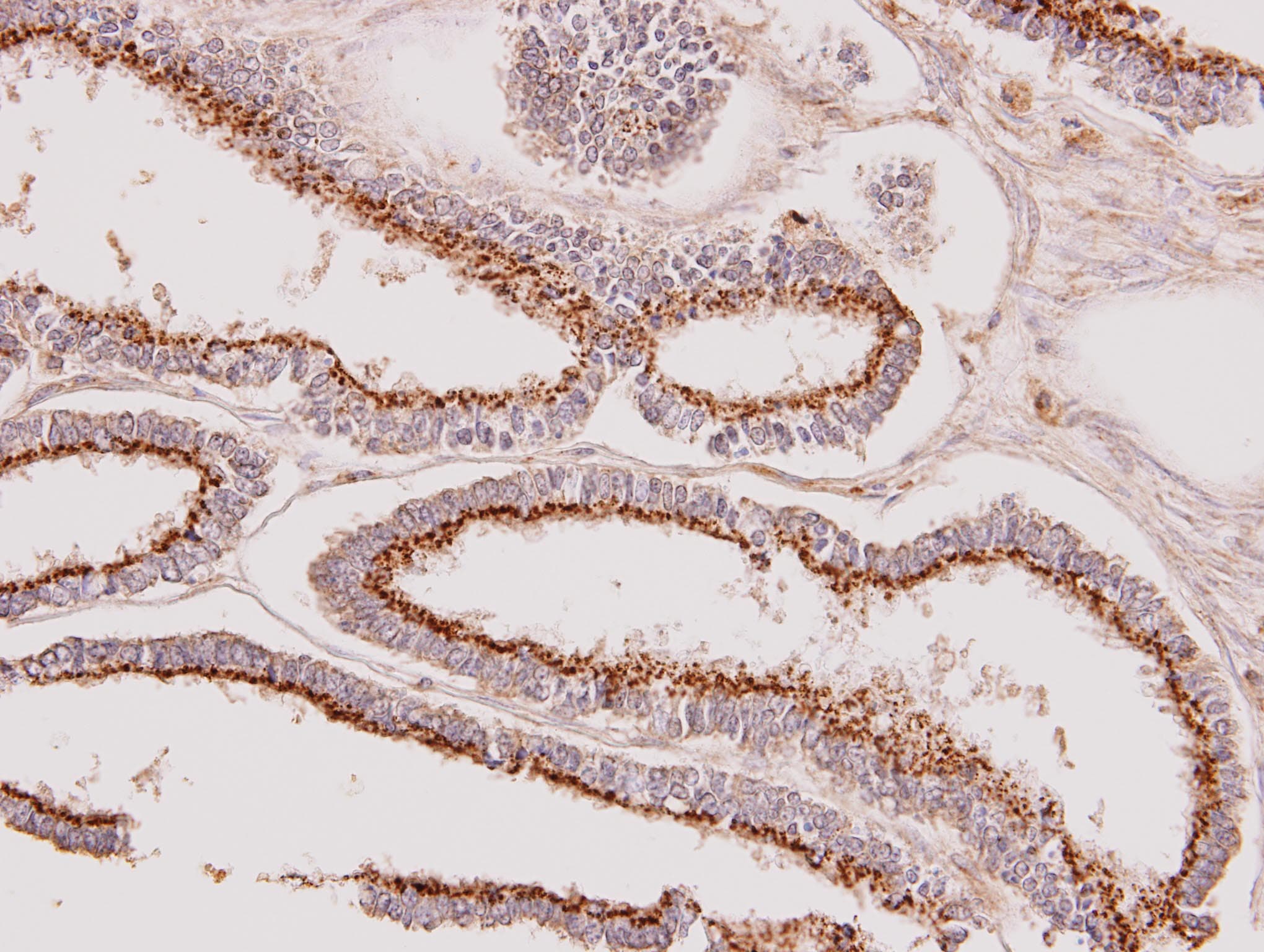Polyclonal Rabbit anti-Human GALNT7 Antibody (aa24-515, IHC, WB)