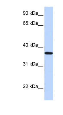Polyclonal Rabbit anti-Human LCN12 Antibody (aa36-85, WB)