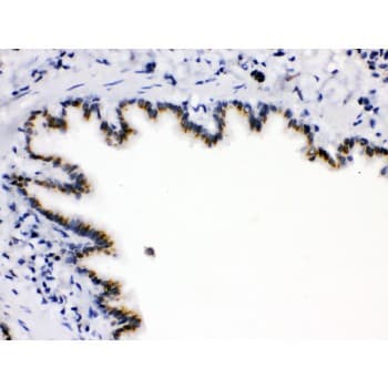 ARSA / Arylsulfatase A Antibody (aa454-482)