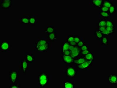 IHC-plus™ Polyclonal Rabbit anti-Human ELAVL2 / HUB Antibody (IHC, WB)