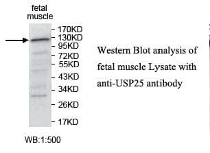 Polyclonal Rabbit anti-Human USP25 Antibody (aa2-220, IHC, WB)