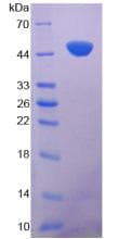 Mouse KL / Klotho Protein (Recombinant His, N-Terminal)