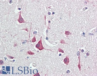 GIGYF2 Antibody (aa375-425)