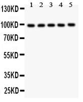 HCN1 Antibody (aa618-890)