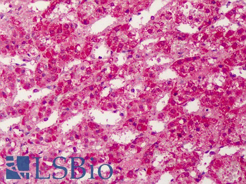 IHC-plus™ PPARG / PPAR Gamma Antibody