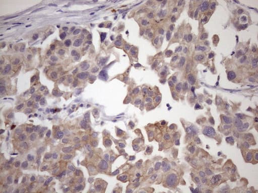 Monoclonal Mouse anti-Human SMCP Antibody (clone OTI6G9, IHC, WB)