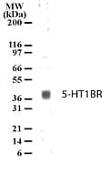 HTR1B / 5-HT1B Receptor Antibody (aa8-26)