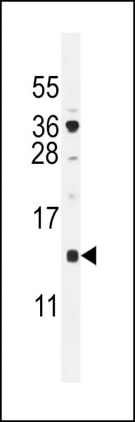 SFT2D2 Antibody (aa1-30)