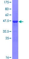 Human Gpnat1 / GNPNAT1 Protein (Recombinant GST)