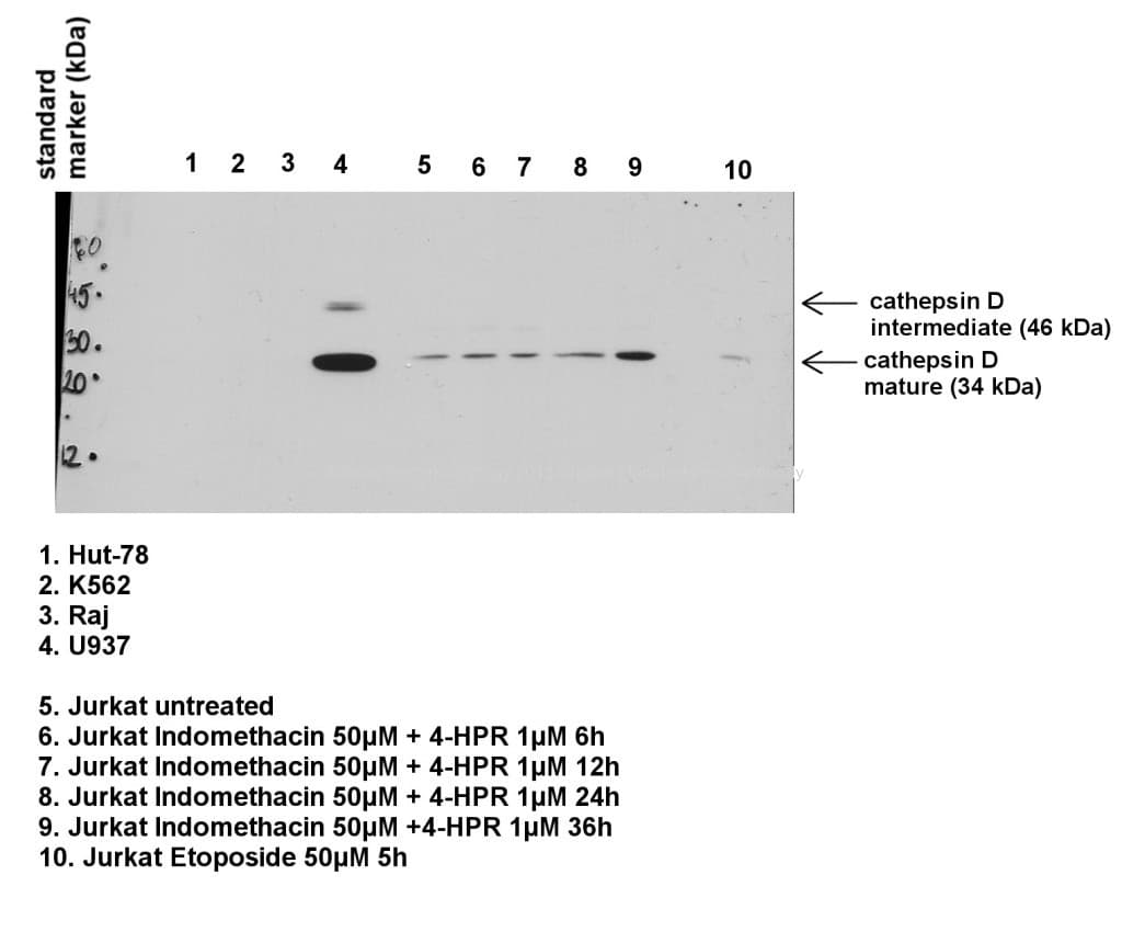 PathPlus™ Polyclonal Rabbit anti-Mouse CTSD / Cathepsin D Antibody (C-Terminus, IHC, WB)
