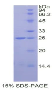 Human COMT Protein (Recombinant His)