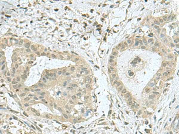THTPA Antibody