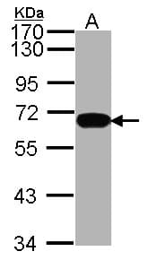IHC-plus™ Polyclonal Rabbit anti-Human HDAC1 Antibody (IHC, IF, WB)