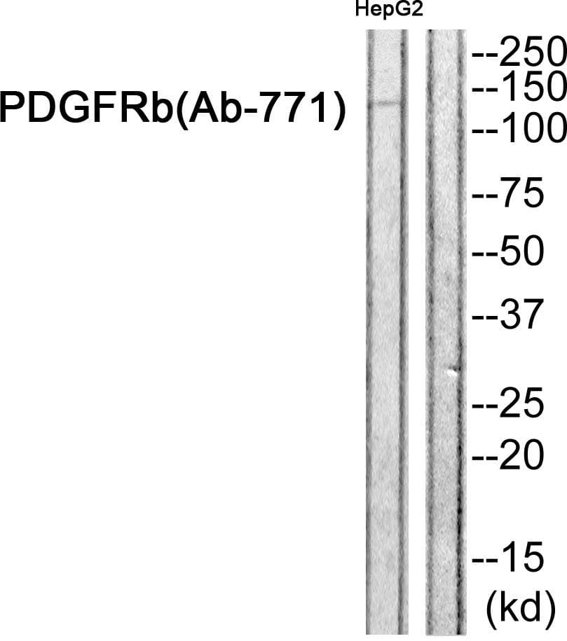 PDGFRB / PDGFR Beta Antibody (p771)