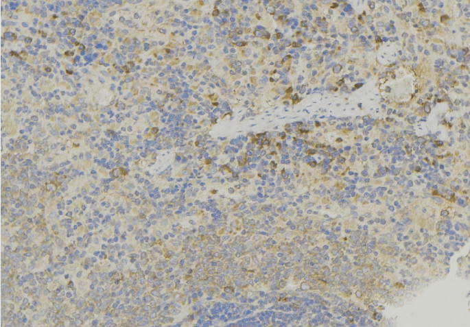 GDI2 Antibody