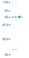 Human ROM1 Protein (Recombinant GST)