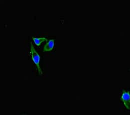 Polyclonal Rabbit anti-Human IFITM5 Antibody (IHC, IF)