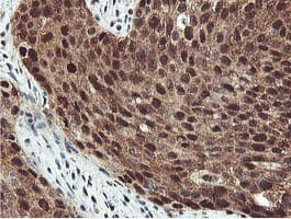 PSMB7 Antibody (clone OTI1E1)