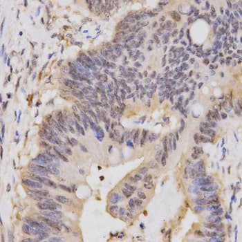 HCF1 / HCFC1 Antibody