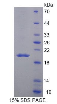 Mouse MARCO Protein (Recombinant His-T7)