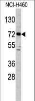 ELP2 / STATIP1 Antibody (aa737-765)