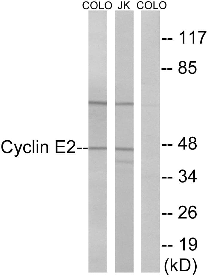 CCNE2 / Cyclin E2 Antibody (aa355-404)