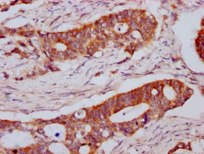 LPL / Lipoprotein Lipase Antibody